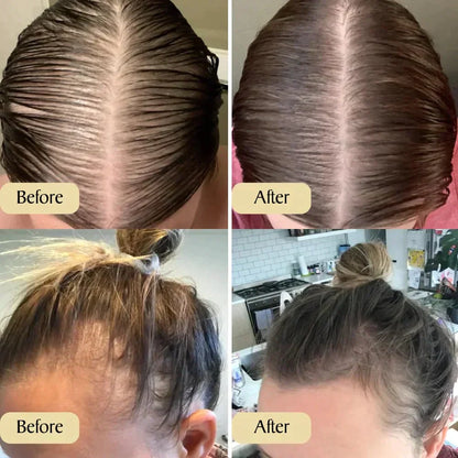 Veganistische haargroeiolie | 1+1 gratis